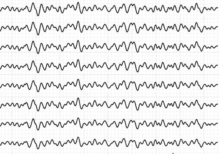 ondes